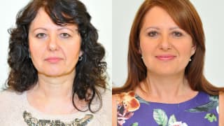 Photo - Facelift, necklift, eyelid adjustment - Alena