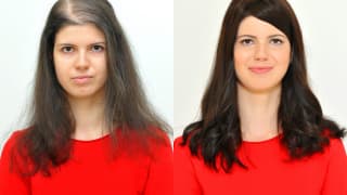 Photo - Solution of sparse hair and lysine - Lucia