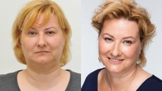 Photo - Double chin - Dagmar