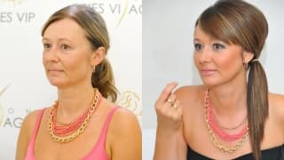 Photo - Thread lifting - Ivana
