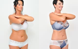SlimLipo