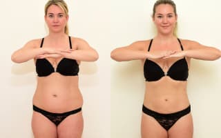 SlimLipo