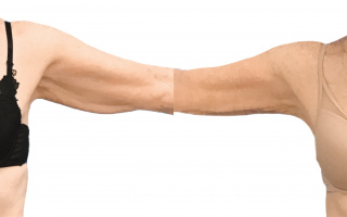 SlimLipo