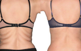 SlimLipo