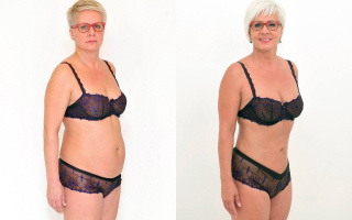 SlimLipo