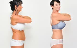 SlimLipo