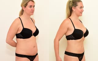 SlimLipo