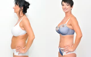 SlimLipo