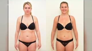 Video - SlimLipo Laser Liposuction - Tereza